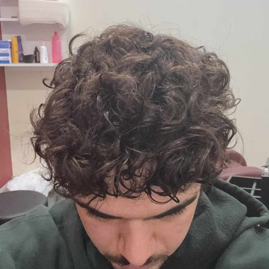 After image 3